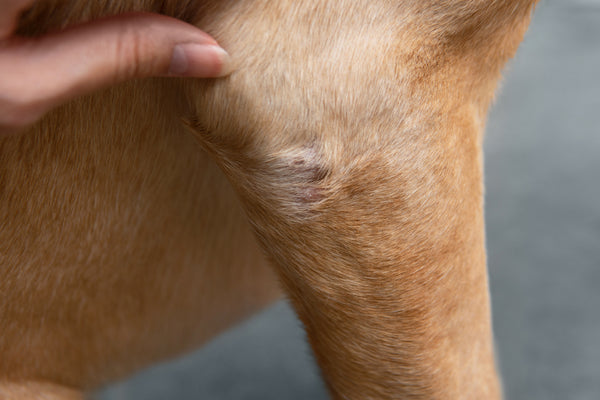Elbows and Dry patches
